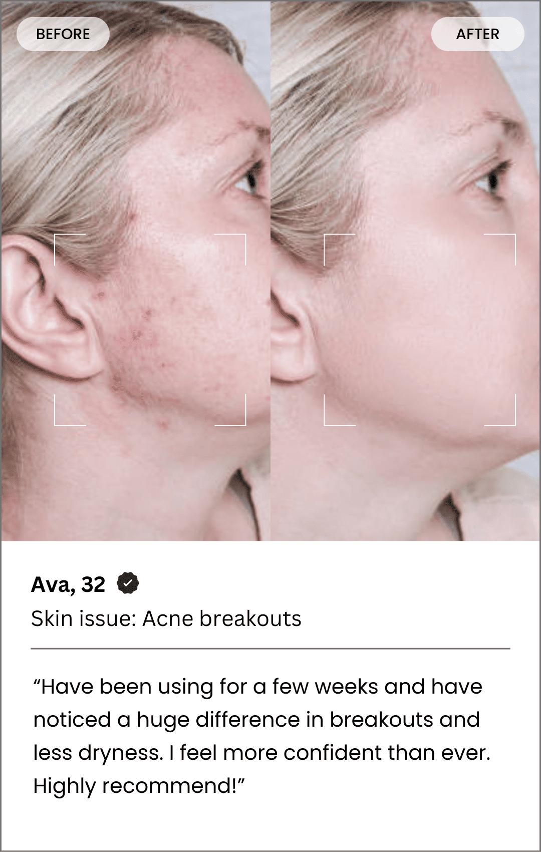 Fybelle Radiance Pro LED Light Therapy Face Mask