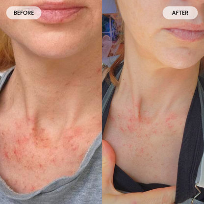 Fybelle Radiance Pro LED Neck & Décolletage Mask